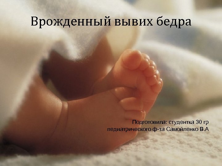 Врожденный вывих бедра Подготовила: студентка 30 гр педиатрического ф-та Самойленко В. А 