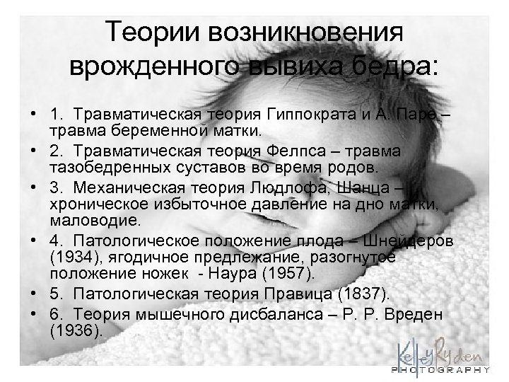 Теории возникновения врожденного вывиха бедра: • 1. Травматическая теория Гиппократа и А. Паре –