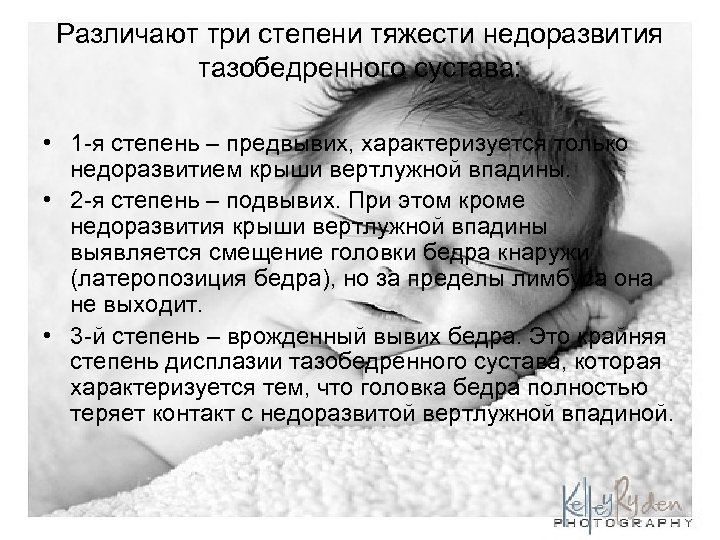 Различают три степени тяжести недоразвития тазобедренного сустава: • 1 -я степень – предвывих, характеризуется