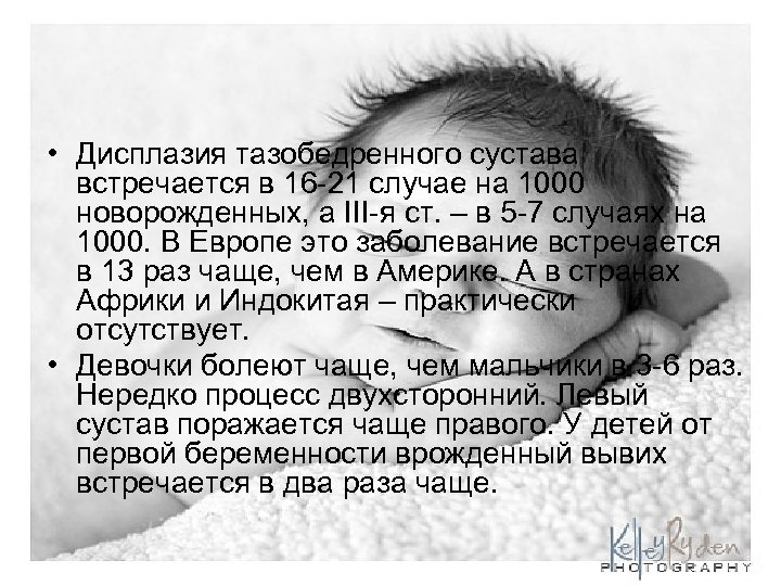  • Дисплазия тазобедренного сустава встречается в 16 -21 случае на 1000 новорожденных, а