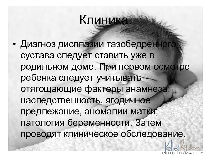 Клиника. • Диагноз дисплазии тазобедренного сустава следует ставить уже в родильном доме. При первом