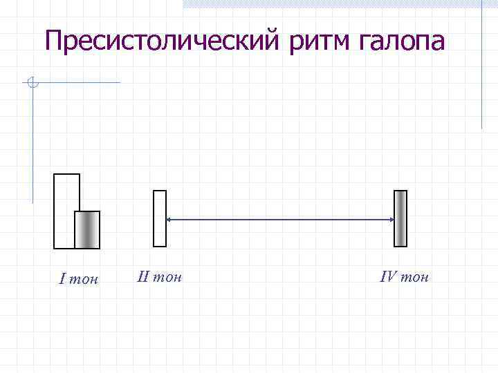 Схема ритма галопа