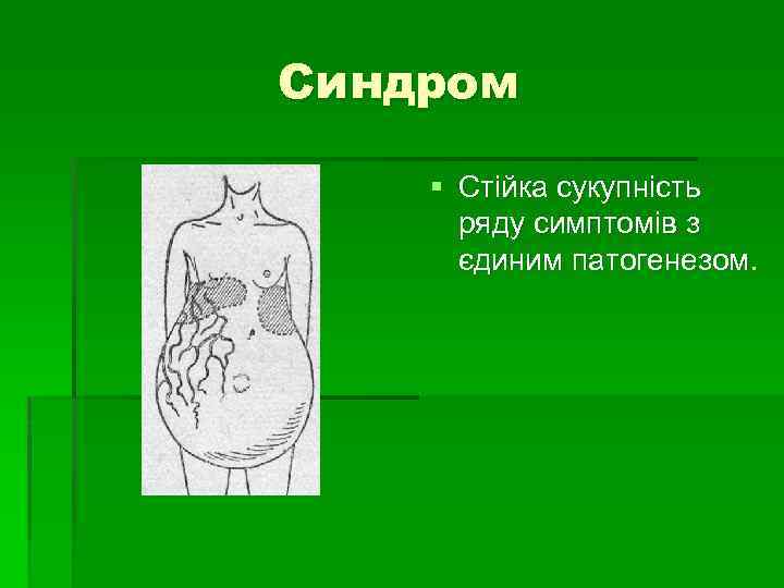 Синдром § Стійка сукупність ряду симптомів з єдиним патогенезом. 