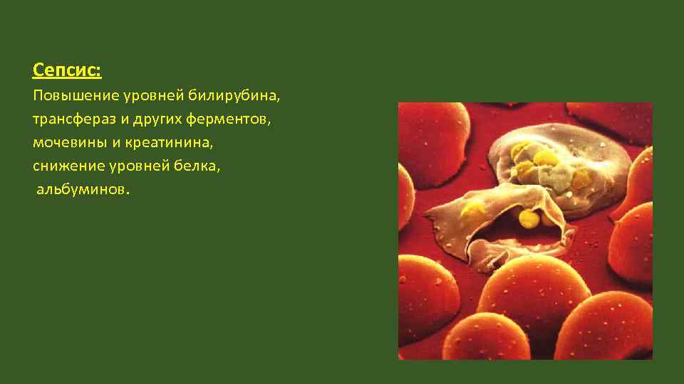 Сепсис: Повышение уровней билирубина, трансфераз и других ферментов, мочевины и креатинина, снижение уровней белка,