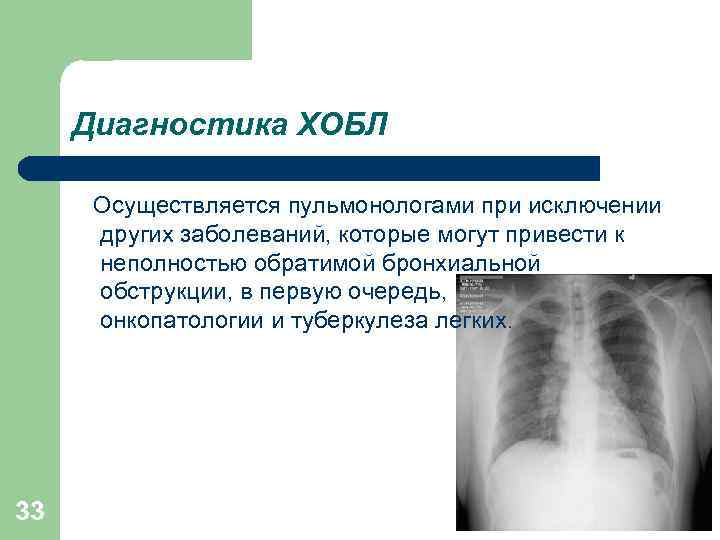Диагностика ХОБЛ Осуществляется пульмонологами при исключении других заболеваний, которые могут привести к неполностью обратимой