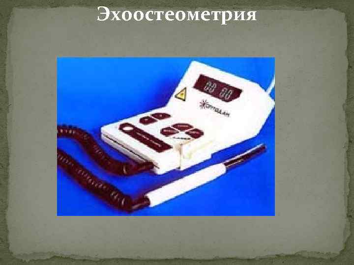 Эхоостеометрия 