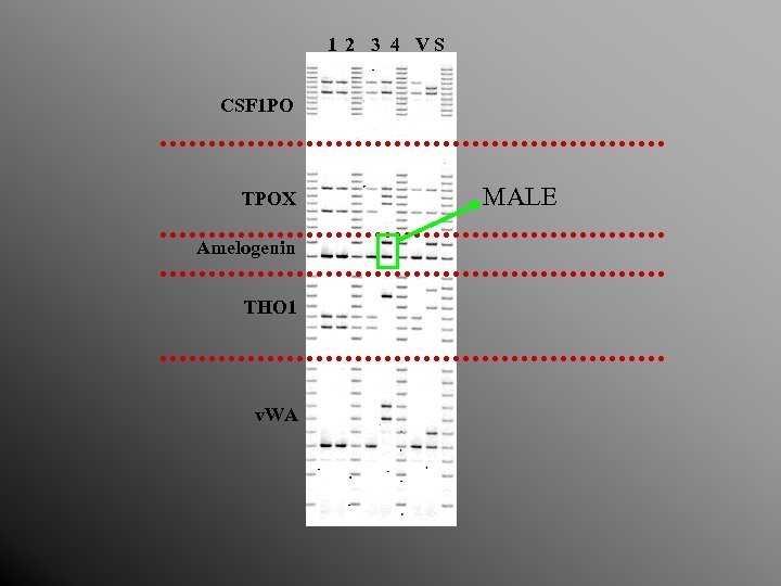 1 2 3 4 VS CSF 1 PO TPOX Amelogenin THO 1 v. WA