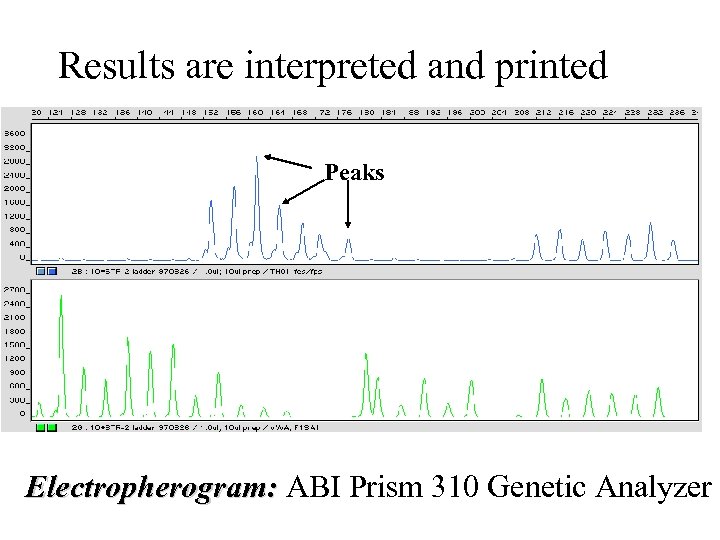 Results are interpreted and printed Peaks Electropherogram: ABI Prism 310 Genetic Analyzer 