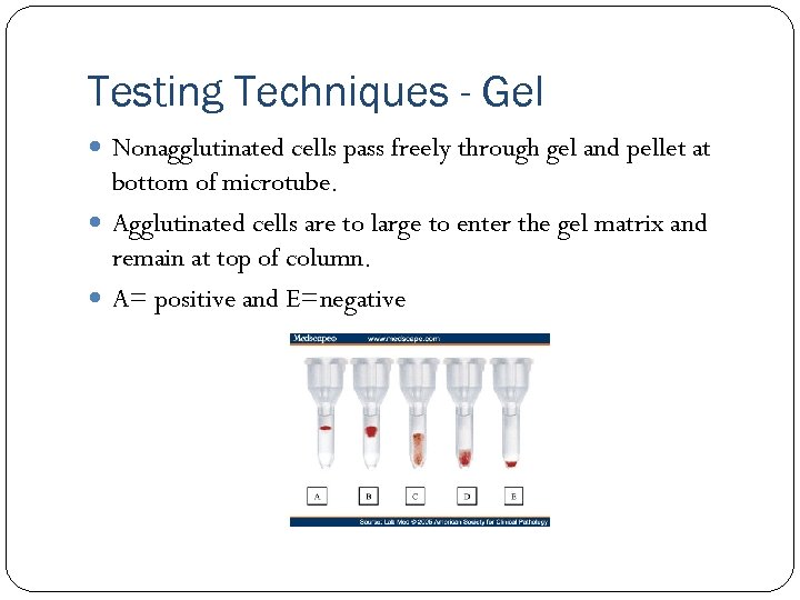 Unit 8 Pretransfusion Testing Part 3 Terry Kotrla