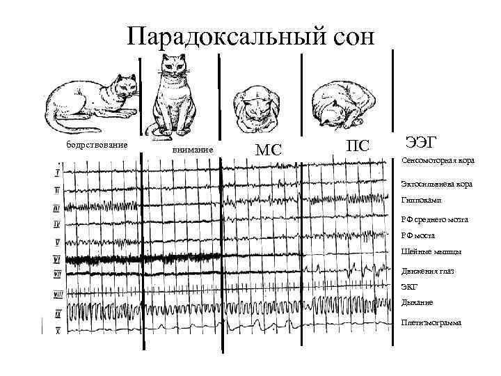 Парадоксальный сон бодрствование внимание МС ПС ЭЭГ Сенсомоторная кора Эктосильвиева кора Гиппокамп РФ среднего