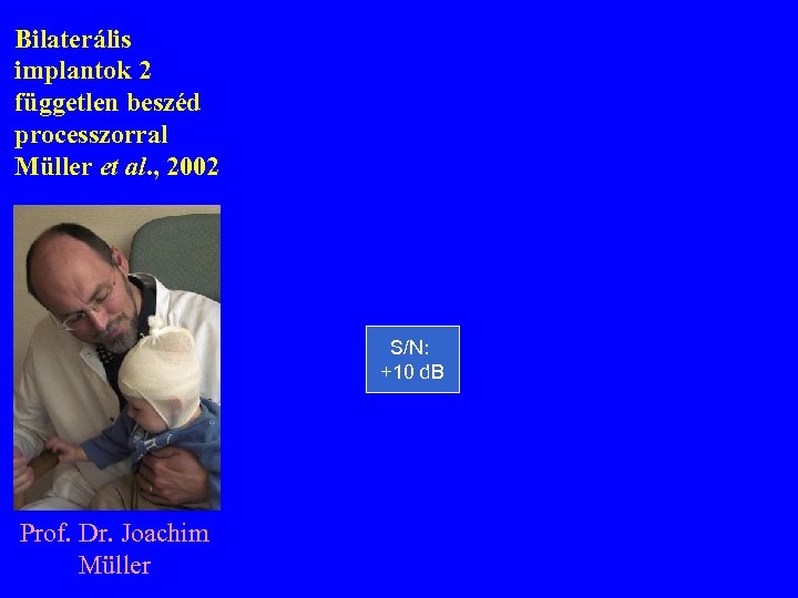 Bilaterális implantok 2 független beszéd processzorral Müller et al. , 2002 S/N: +10 d.