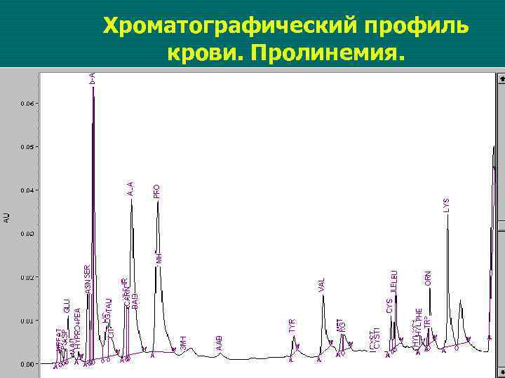 Хроматографический профиль крови. Пролинемия. 