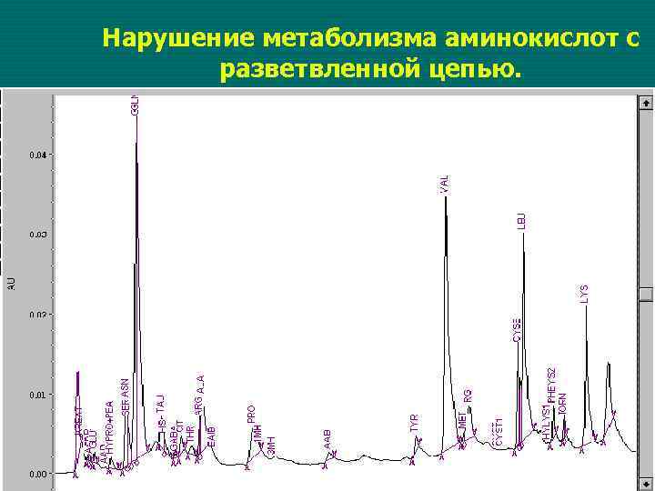 Нарушение метаболизма аминокислот с разветвленной цепью. 