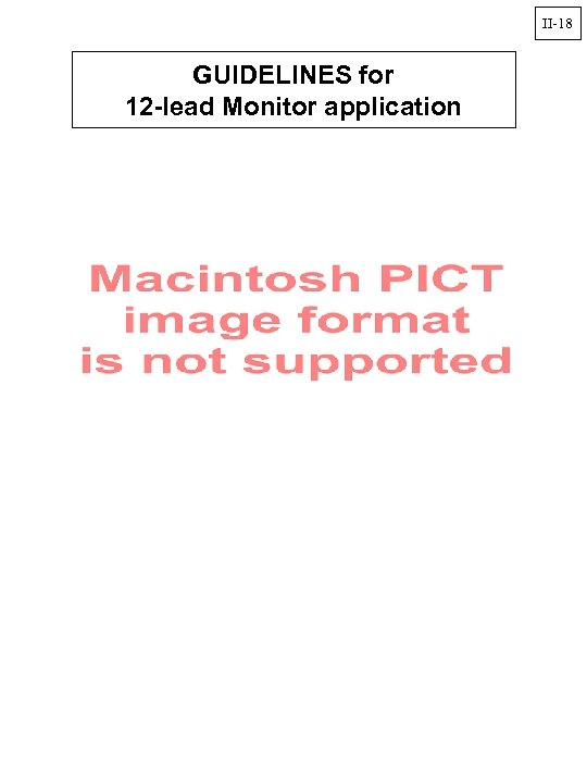 II-18 GUIDELINES for 12 -lead Monitor application 