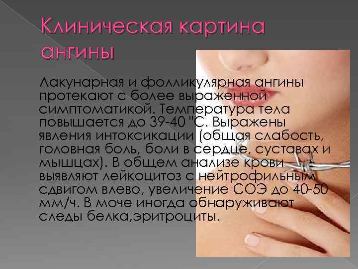 Клиническая картина ангины Лакунарная и фолликулярная ангины протекают с более выраженной симптоматикой. Температура тела