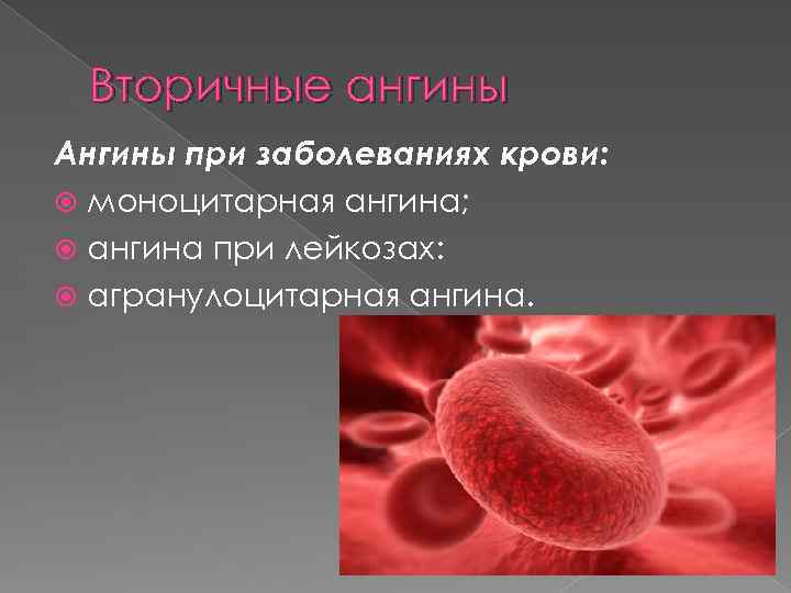 Вторичные ангины Ангины при заболеваниях крови: моноцитарная ангина; ангина при лейкозах: агранулоцитарная ангина. 