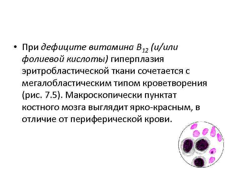 Миелограмма костного мозга. Мегалобластический и эритробластический. Мегалобласты норма миелограмма. Пунктат костного мозга норма. Мегалобластическое кроветворение.