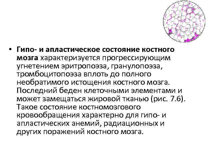  • Гипо- и апластическое состояние костного мозга характеризуется прогрессирующим угнетением эритропоэза, гранулопоэза, тромбоцитопоэза