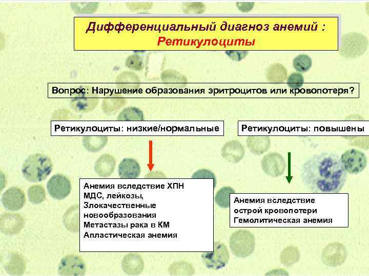 Дифференциальный диагноз анемий : Ретикулоциты Вопрос: Нарушение образования эритроцитов или кровопотеря? Ретикулоциты: низкие/нормальные Анемия