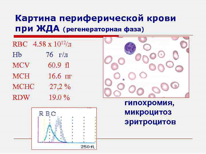 Картина периферической крови при железодефицитной анемии