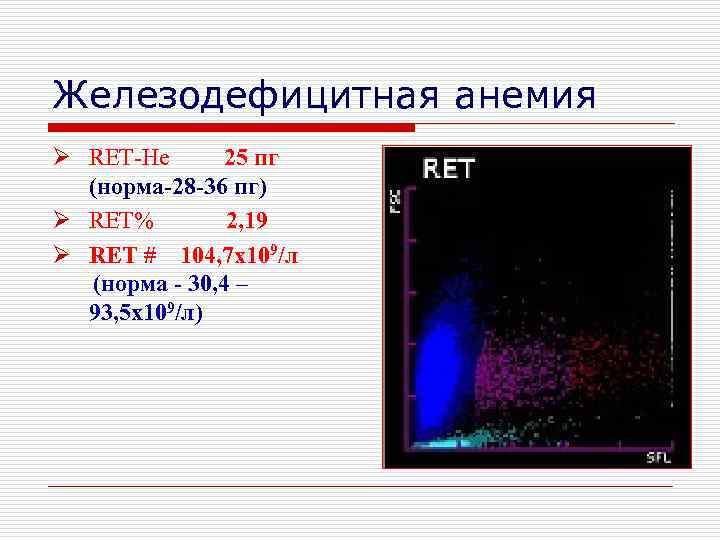Железодефицитная анемия Ø RET-He 25 пг (норма-28 -36 пг) Ø RET% 2, 19 Ø