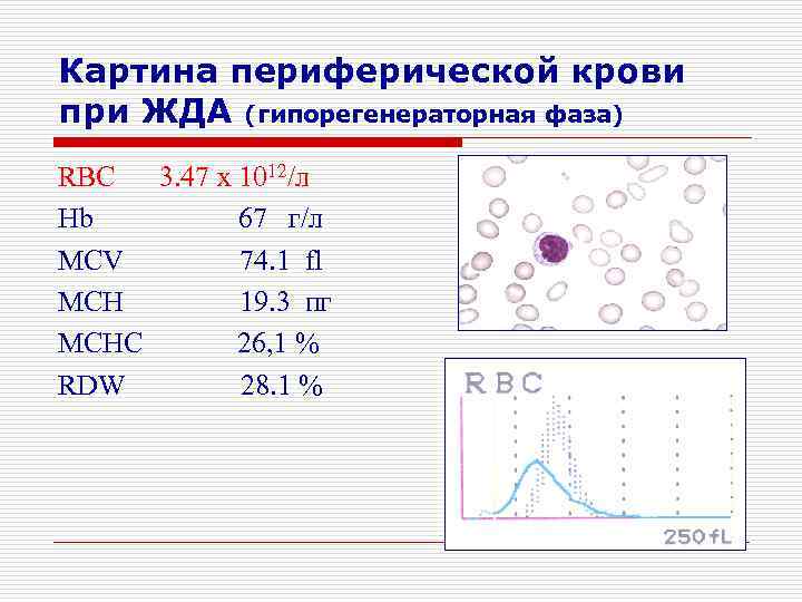 Картина периферической крови при ЖДА (гипорегенераторная фаза) RBC 3. 47 x 1012/л Hb 67