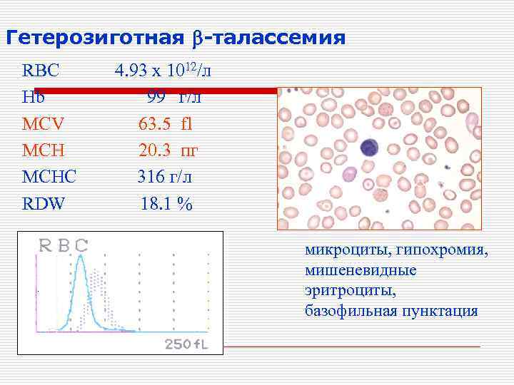Гетерозиготная -талассемия RBC Hb MCV MCHC RDW 4. 93 x 1012/л 99 г/л 63.