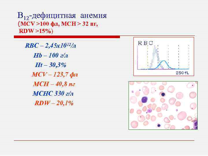В 12 -дефицитная анемия (MCV >100 фл, MCH > 32 пг, RDW >15%) RBC