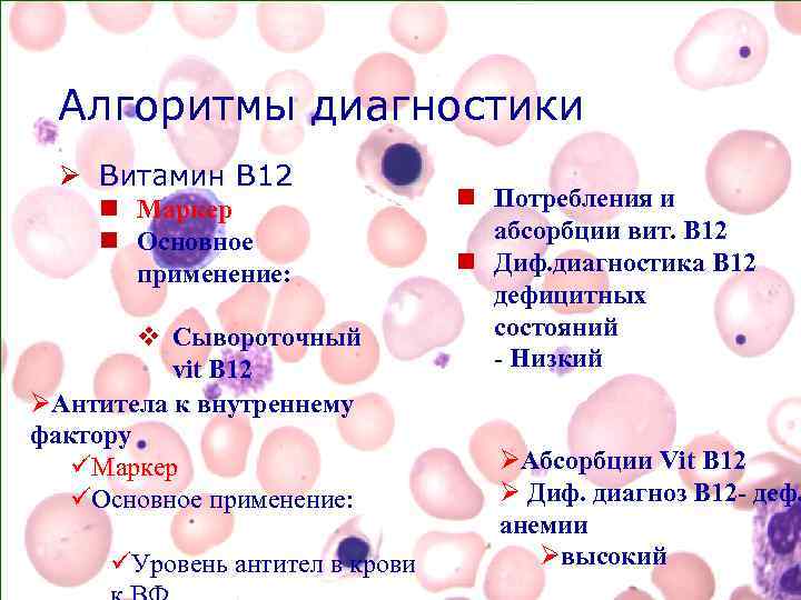 Алгоритмы диагностики Ø Витамин B 12 n Маркер n Основное применение: v Сывороточный vit