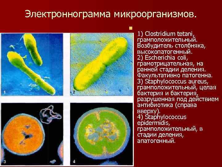 Электроннограмма микроорганизмов. n 1) Clostridium tetani, грамположительный. Возбудитель столбняка, высокопатогенный. 2) Escherichia coli, грамотрицательная,