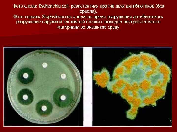 Фото слева: Escherichia соli, резистентная против двух антибиотиков (без ореола). Фото справа: Staphylococcus aureus