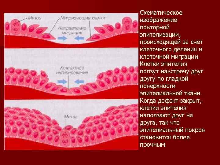 Схематическое изображение повторной эпителизации, происходящей за счет клеточного деления и клеточной миграции. Клетки эпителия