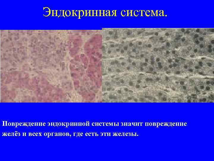 Эндокринная система. Повреждение эндокринной системы значит повреждение желёз и всех органов, где есть эти