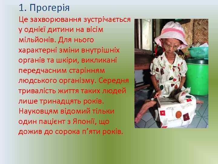 1. Прогерія Це захворювання зустрічається у однієї дитини на вісім мільйонів. Для нього характерні