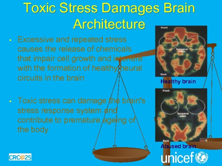 Toxic Stress Damages Brain Architecture • • Excessive and repeated stress causes the release
