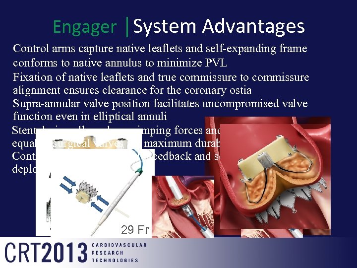 Engager │System Advantages Control arms capture native leaflets and self-expanding frame conforms to native