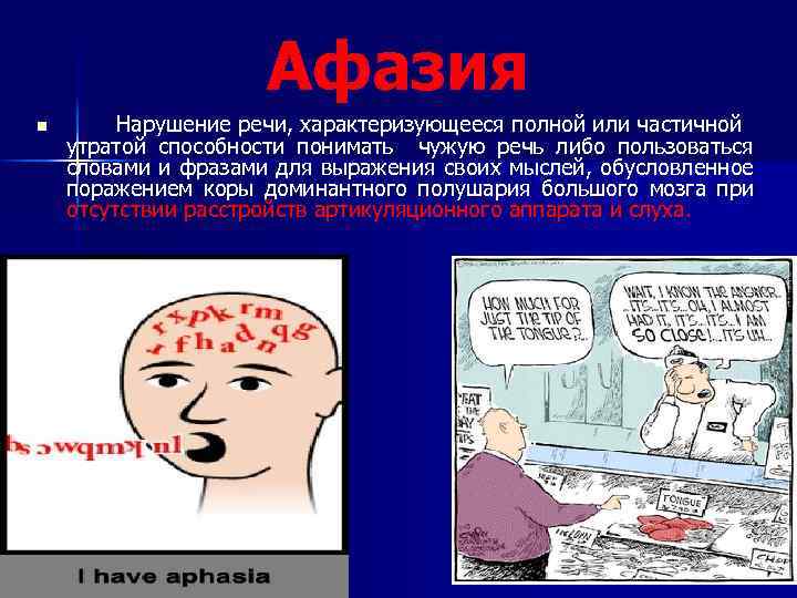 Афазия n Нарушение речи, характеризующееся полной или частичной утратой способности понимать чужую речь либо