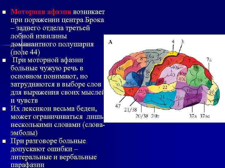 n n Моторная афазия возникает при поражении центра Брока – заднего отдела третьей лобной