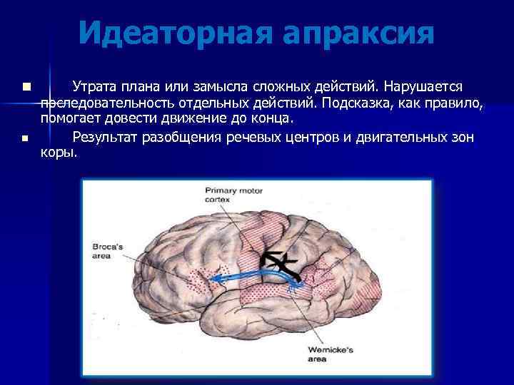 Идеаторная апраксия n n Утрата плана или замысла сложных действий. Нарушается последовательность отдельных действий.