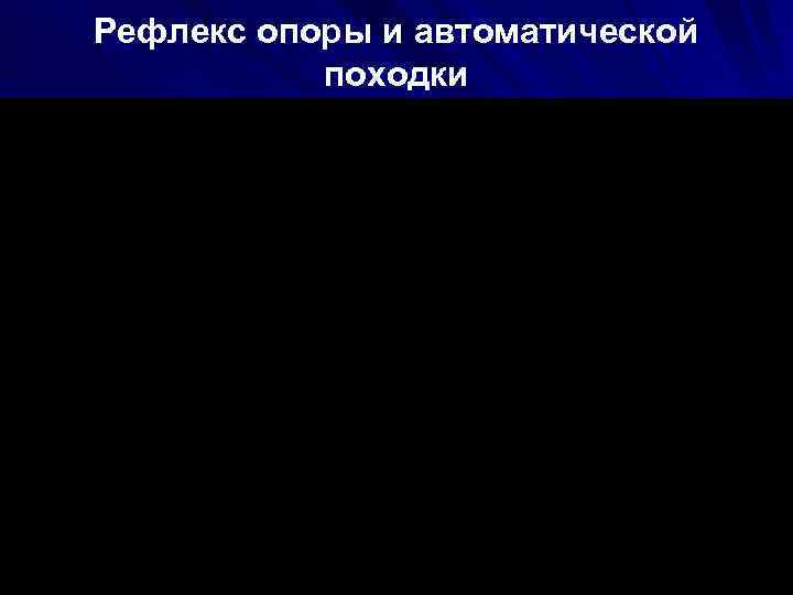 Рефлекс опоры и автоматической походки 