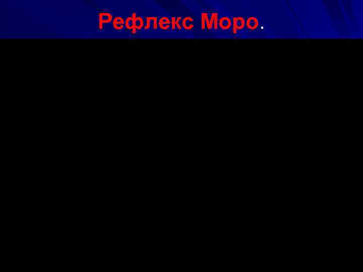 Рефлекс Моро. 
