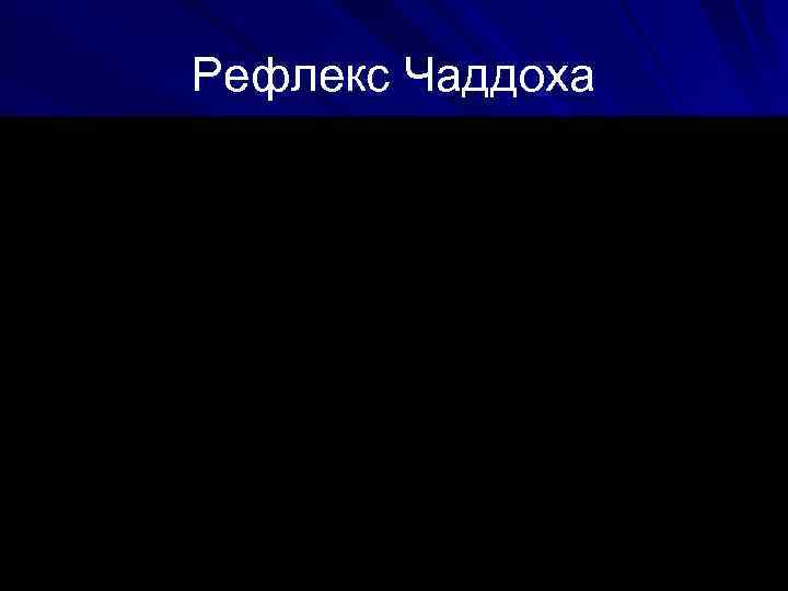 Рефлекс Чаддоха 