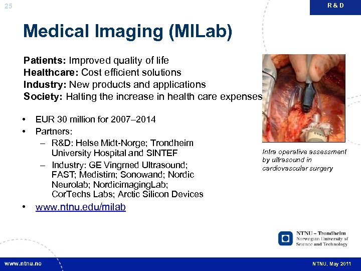 R&D 25 Medical Imaging (MILab) Patients: Improved quality of life Healthcare: Cost efficient solutions