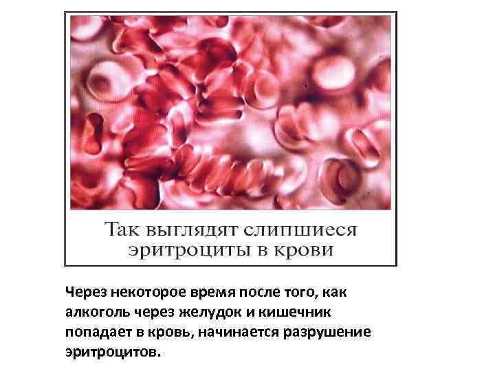 Через некоторое время после того, как алкоголь через желудок и кишечник попадает в кровь,