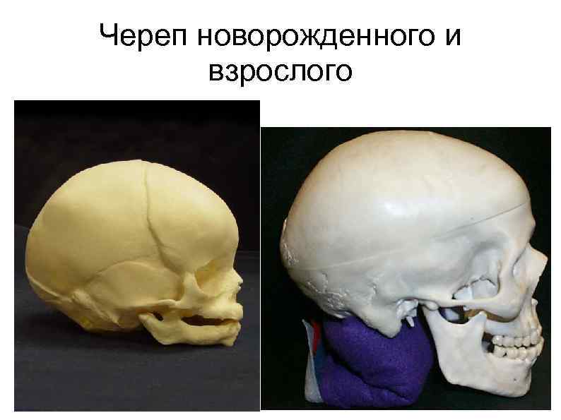 Строение черепа у новорожденных детей фото