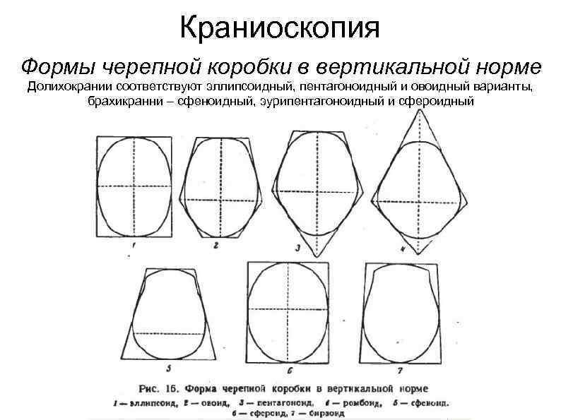 Краниоскопия Формы черепной коробки в вертикальной норме Долихокрании соответствуют эллипсоидный, пентагоноидный и овоидный варианты,