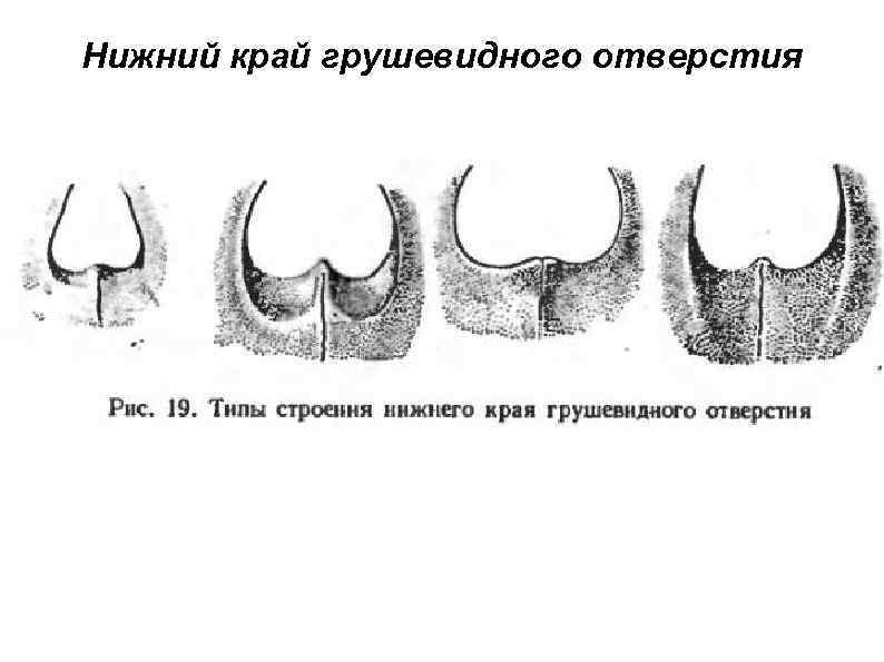 Нижний край грушевидного отверстия 