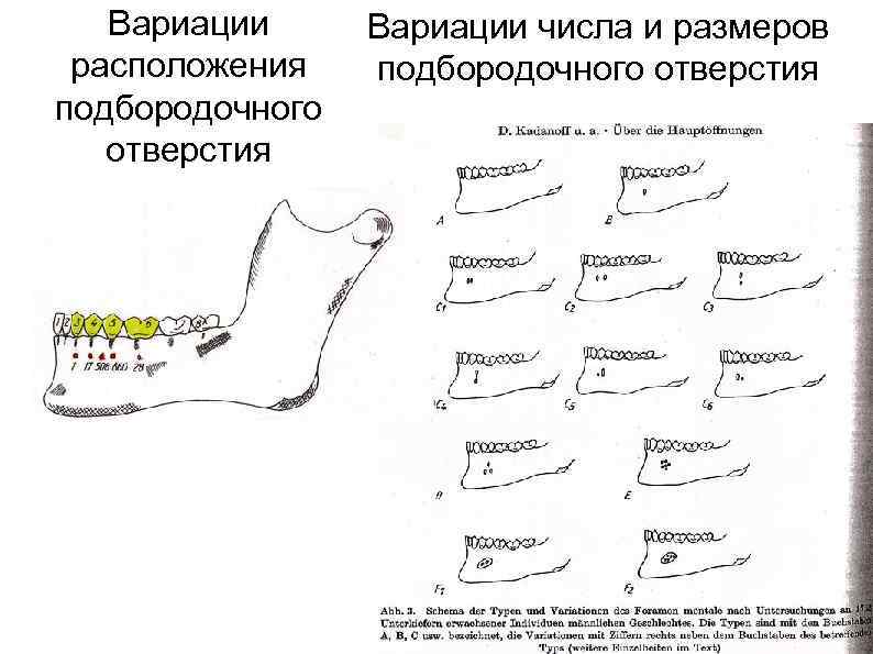 Вариации расположения подбородочного отверстия Вариации числа и размеров подбородочного отверстия 