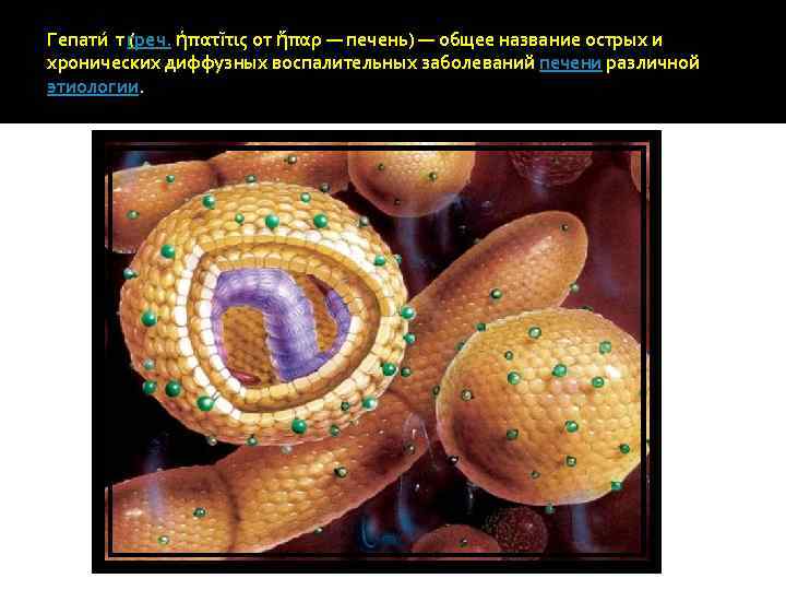Гепати т (реч. ἡπατῖτις от ἥπαρ — печень) — общее название острых и г