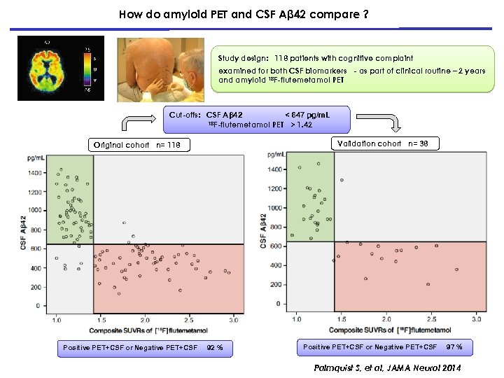How do amyloid PET and CSF Aβ 42 compare ? Study design: 118 patients